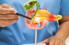 Làm thế nào để nhận ra dấu hiệu cảnh báo sỏi mật giai đoạn đầu?