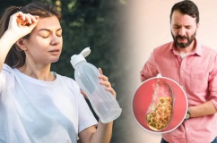 Uống ít nước có làm tăng nguy cơ bị sỏi mật không?