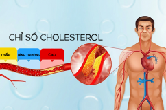 Tăng cholesterol kéo dài: Mối nguy âm thầm thúc đẩy xơ vữa động mạch
