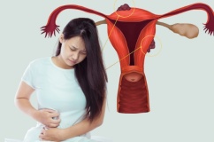 Sang chấn tâm lý có thể thúc đẩy bệnh lạc nội mạc tử cung