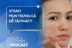 Podcast: Vì sao mụn trứng cá dễ tái phát?