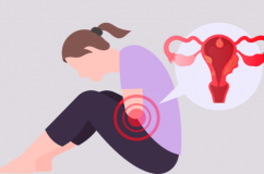 Nhân xơ tử cung có phải ung thư?