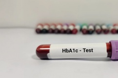 Đái tháo đường: Chỉ số HbA1c 8,9% làm cách nào để hạ?