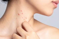 Hướng đi mới giúp kiểm soát bệnh lupus ban đỏ từ thảo dược tự nhiên
