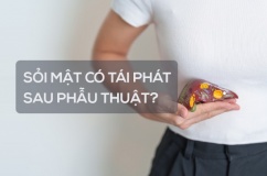 Sỏi mật có tái phát sau phẫu thuật không?
