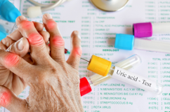 Chế độ ăn cho người có chỉ số acid uric tăng cao