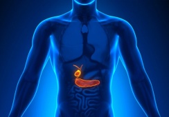 Sỏi lấp đầy túi mật, dùng TPBVSK Kim Đởm Khang được không?