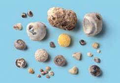 Sỏi mật 7mm: Dùng TPBVSK Kim Đởm Khang được không?