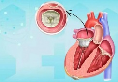 Bệnh hở van tim và tim to có chữa khỏi được không?