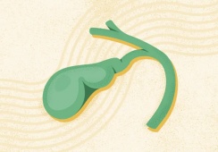 Có sỏi mật 15mm, hay bị đau hạ sườn phải nên xử trí thế nào?