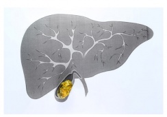 Cách tẩy sỏi gan 1 ngày có hiệu quả với sỏi 4,5mm không?