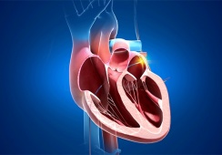 Đốt điện tim rồi vẫn tái phát, có nên tiếp tục can thiệp hay chuyển hướng khác?