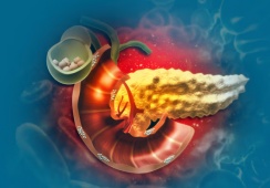 Sau ERCP lấy sỏi mật 1 tuần, dùng TPBVSK Kim Đởm Khang được không?