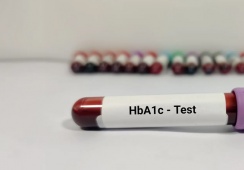 Đái tháo đường: Chỉ số HbA1c 8,9% làm cách nào để hạ?