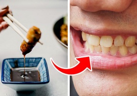 7 thực phẩm gây ố vàng răng bạn nên tránh