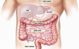 Thảo dược 'trị' IBS