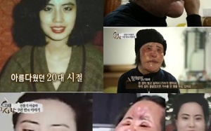 'Méo mó' nhan sắc showbiz Châu Á: Thảm họa phẫu thuật thẩm mỹ