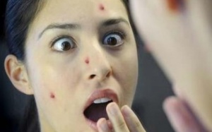 Video: Vị trí mụn mọc tiết lộ gây sốc về sức khỏe