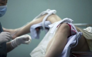 Những lưu ý quan trọng khi nạo hút thai