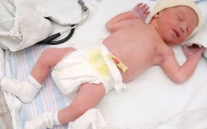 1 phút 1 trẻ chết vì uốn ván