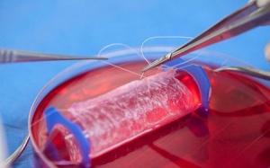 Điểm lại các thành tựu của y học hiện đại năm 2014