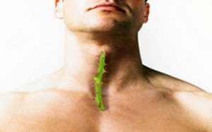 Viêm họng bình thường, coi thường sẽ mất mạng