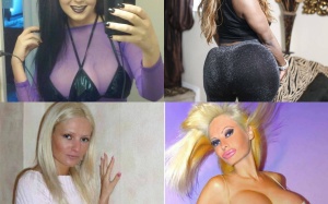 Những 'thảm họa' phẫu thuật thẩm mỹ gây sốc nă​m 2014