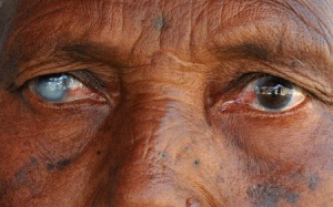 Mù bẩm sinh cũng có thể thấy được ánh sáng