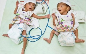 Kỳ lạ cụ bà sinh đôi ở tuổi 70