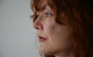 Méo mặt vì phẫu thuật thẩm mỹ