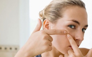 Mụn trắng xung quanh mắt chữa thế nào?