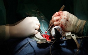 Chữa truỵ tim bằng tế bào gốc