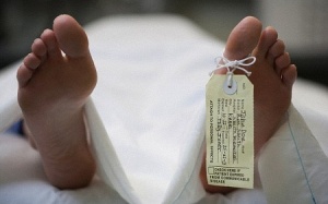 Dùng da người chết để ghép cho người sống