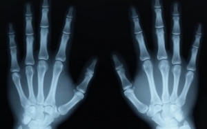 Chụp X-quang có nguy hiểm?