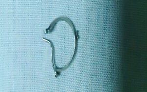 Gắp khuyên tai trong thực quản bệnh nhi 5 tháng tuổi