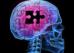 Đâu là 'Tiêu chuẩn vàng' để phát hiện sớm bệnh Alzheimer?