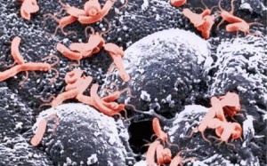 Loét dạ dày vì vi khuẩn HP