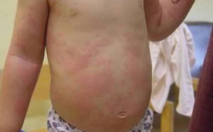 Trẻ 4 tuổi có dùng được TPCN Phụ Bì Khang?