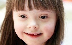 Người mắc bệnh Down - một phần 'vẻ đẹp và sự đa dạng của nhân loại'