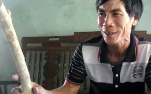 Cây thuốc lạ cứu sống người bị hỏng 2 quả thận