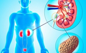 2 bài thuốc dân gian đánh tan sỏi thận hiệu quả