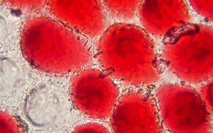 7 thói quen nguy hiểm khiến bạn dễ mắc ung thư