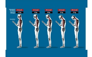 Thoái hóa cột sống vì smart phone