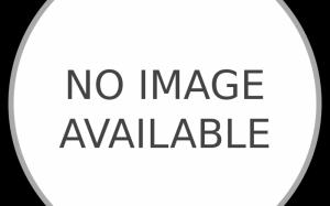 Thiếu nữ xinh đẹp rụng sạch tóc vì căng thẳng khi yêu