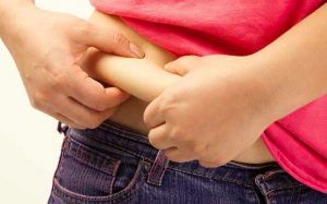 Béo phì, ăn kiêng và CWP