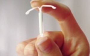 Điều cần biết khi đặt vòng tránh thai