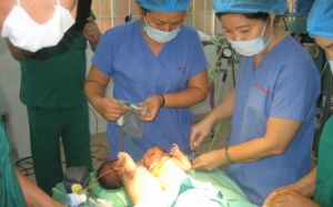 Phẫu thuật thành công ca song sinh dính liền tại Kon Tum