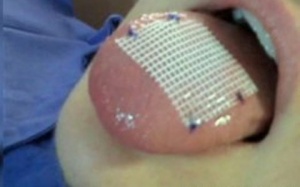 Rùng mình những cách giảm cân kinh dị