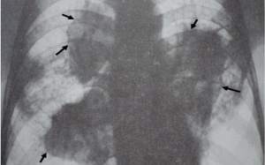 Quần bò Trung Quốc thực sự gây bệnh chết người?