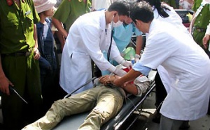 Tai nạn điện giật, phải cắt bỏ chi